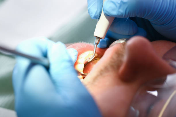 Best Emergency Treatment for Toothache in Elkton, KY