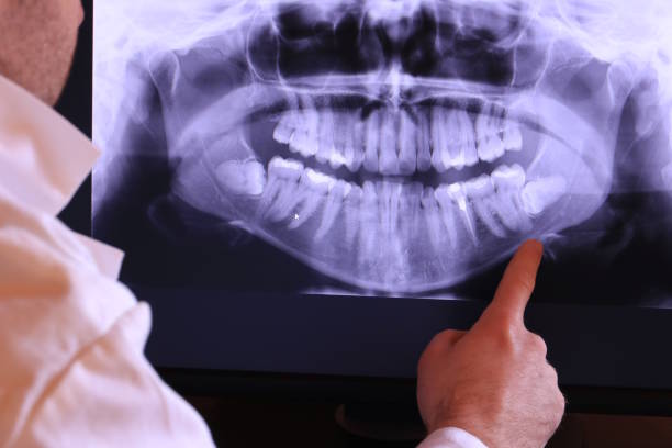 Best Emergency Wisdom Teeth Removal in Elkton, KY